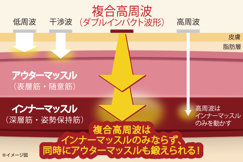 当社独自に開発した「複合高周波」は日米で特許を取得